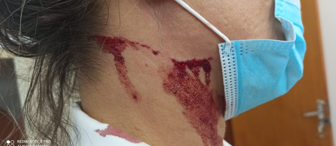 Técnica de enfermagem é ferida por preso da PEM