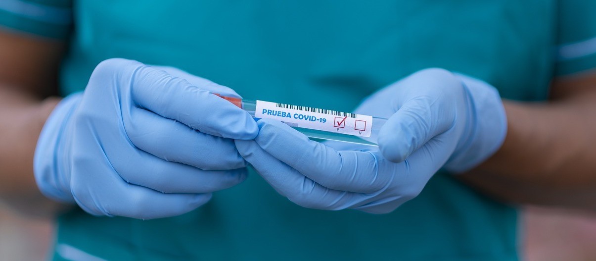 Coronavírus: Confira os dados do boletim desta terça-feira (15) em Maringá