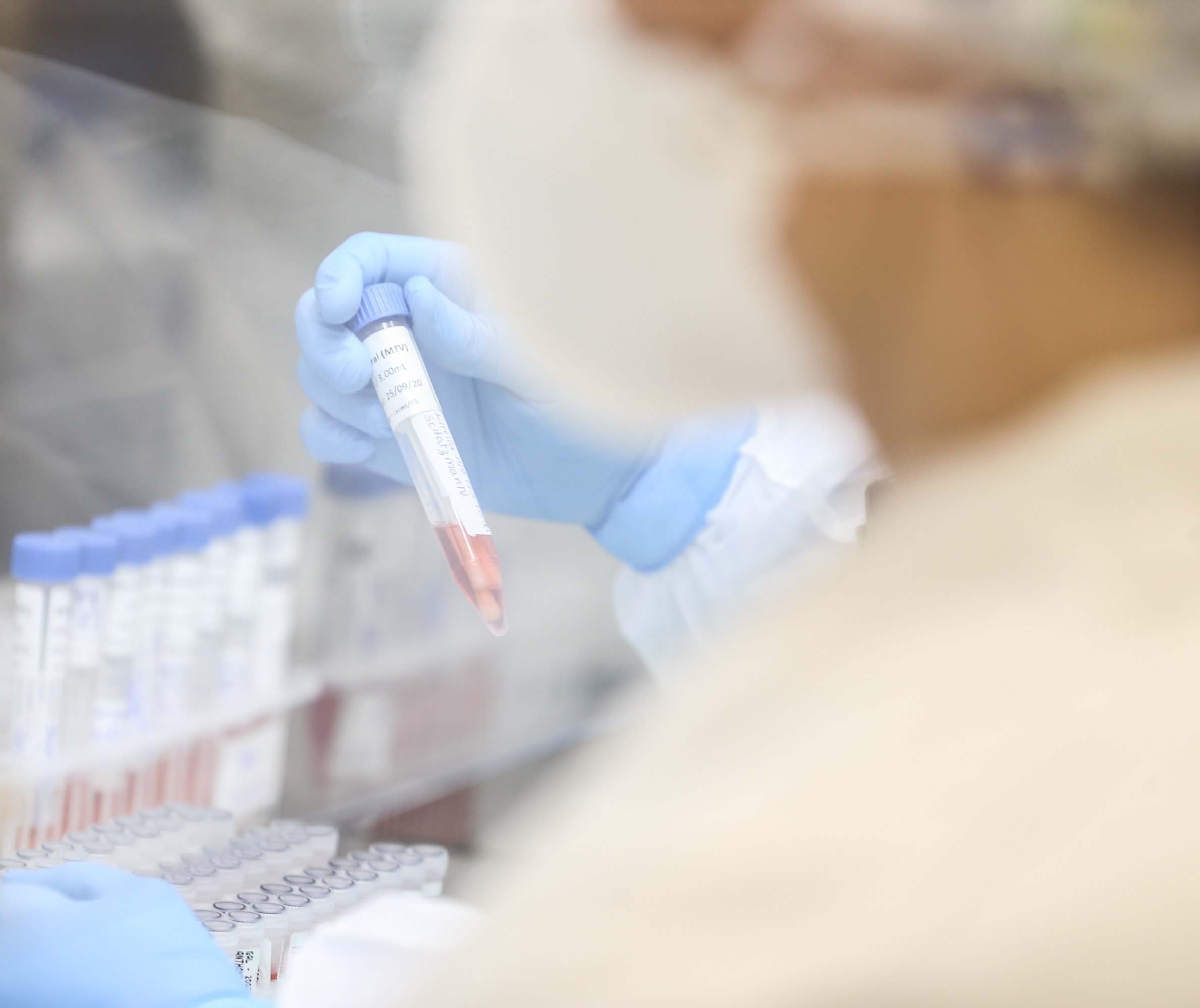 Sesa confirma 224 novos casos de Influenza H3N2