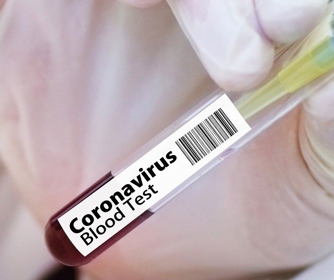 Confira os dados sobre coronavírus deste sábado (26) 