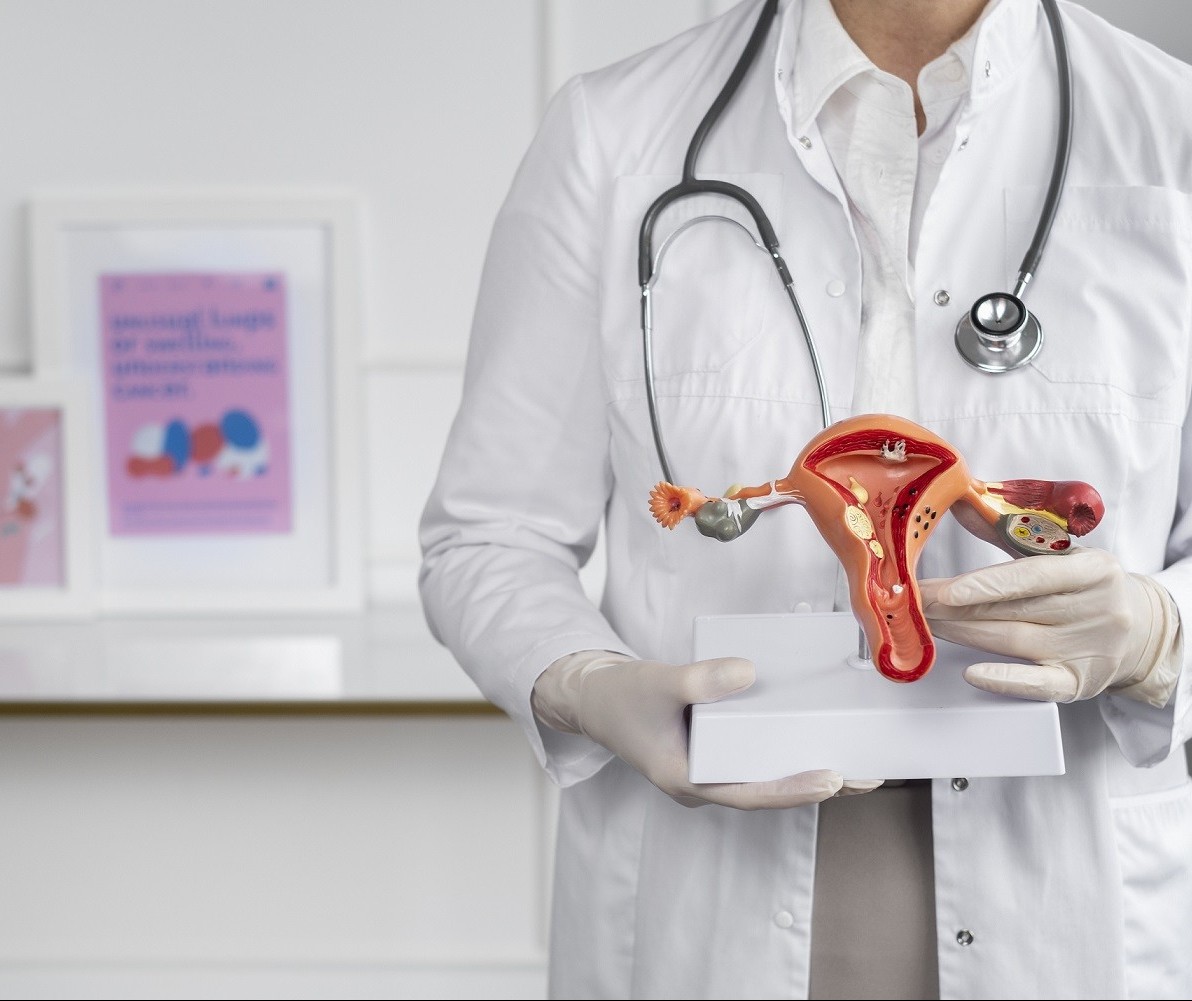 Quais os tratamentos indicados para miomas uterinos?