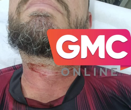 Motociclista sofre corte no pescoço provocado por linha chilen