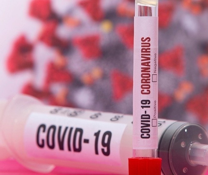 Confira o boletim de casos do coronavírus deste domingo (4)