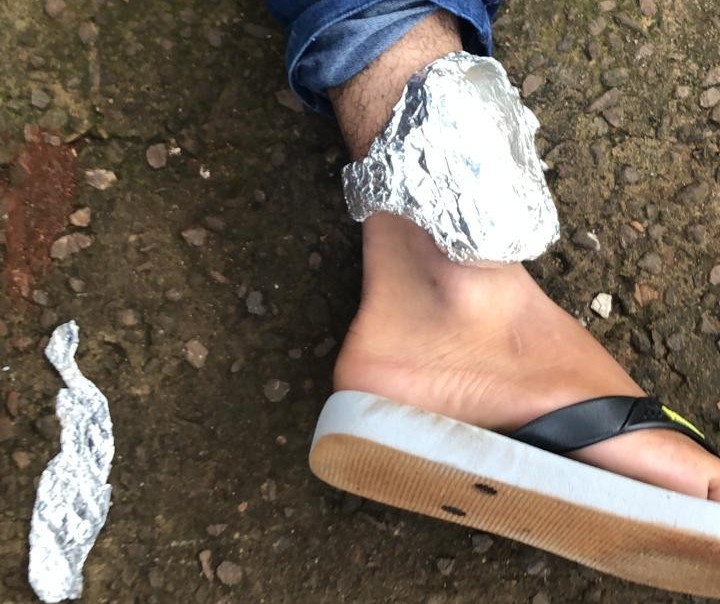 Suspeito cobre tornozeleira eletrônica com papel alumínio mas é preso