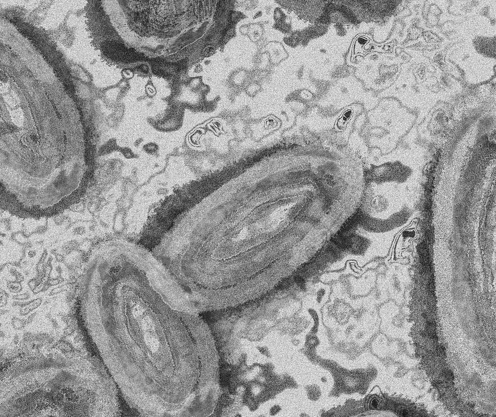 Primeiro caso de varíola dos macacos é confirmado em Ponta Grossa