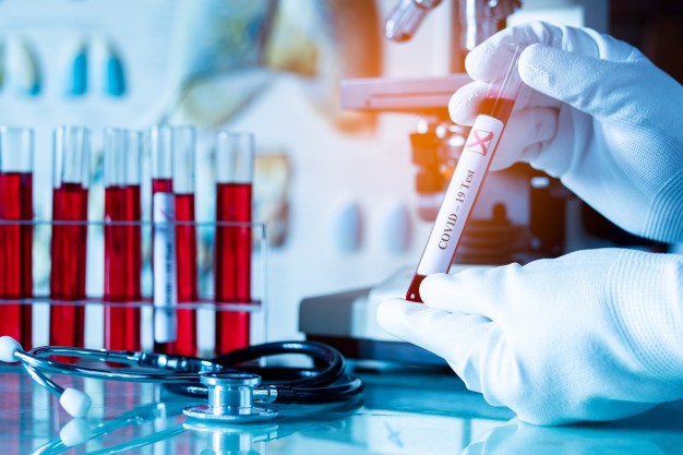 Maringá tem mais três casos confirmados da Covid-19