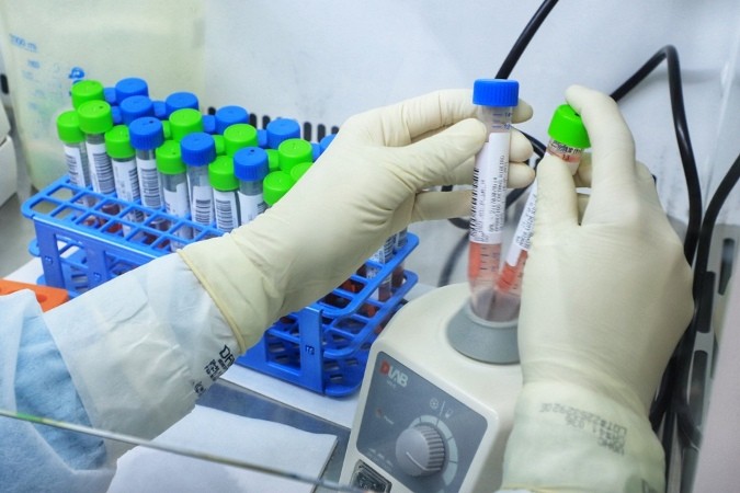 Confira os dados do boletim sobre a Covid-19 desta quarta-feira (6) em Maringá