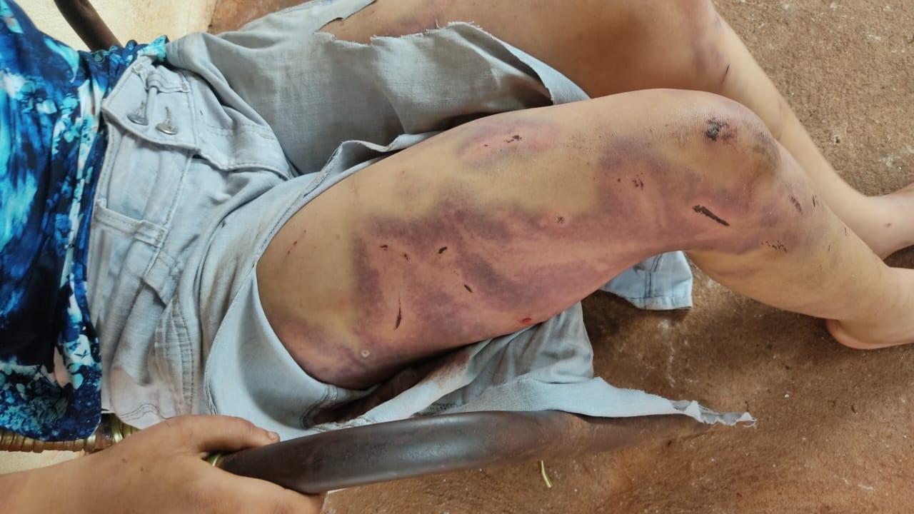 Mulher vítima de tortura e violência sexual é resgatada por guardas municipais
