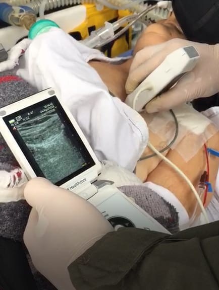 Ultrassom portátil permite avaliação médica em minutos