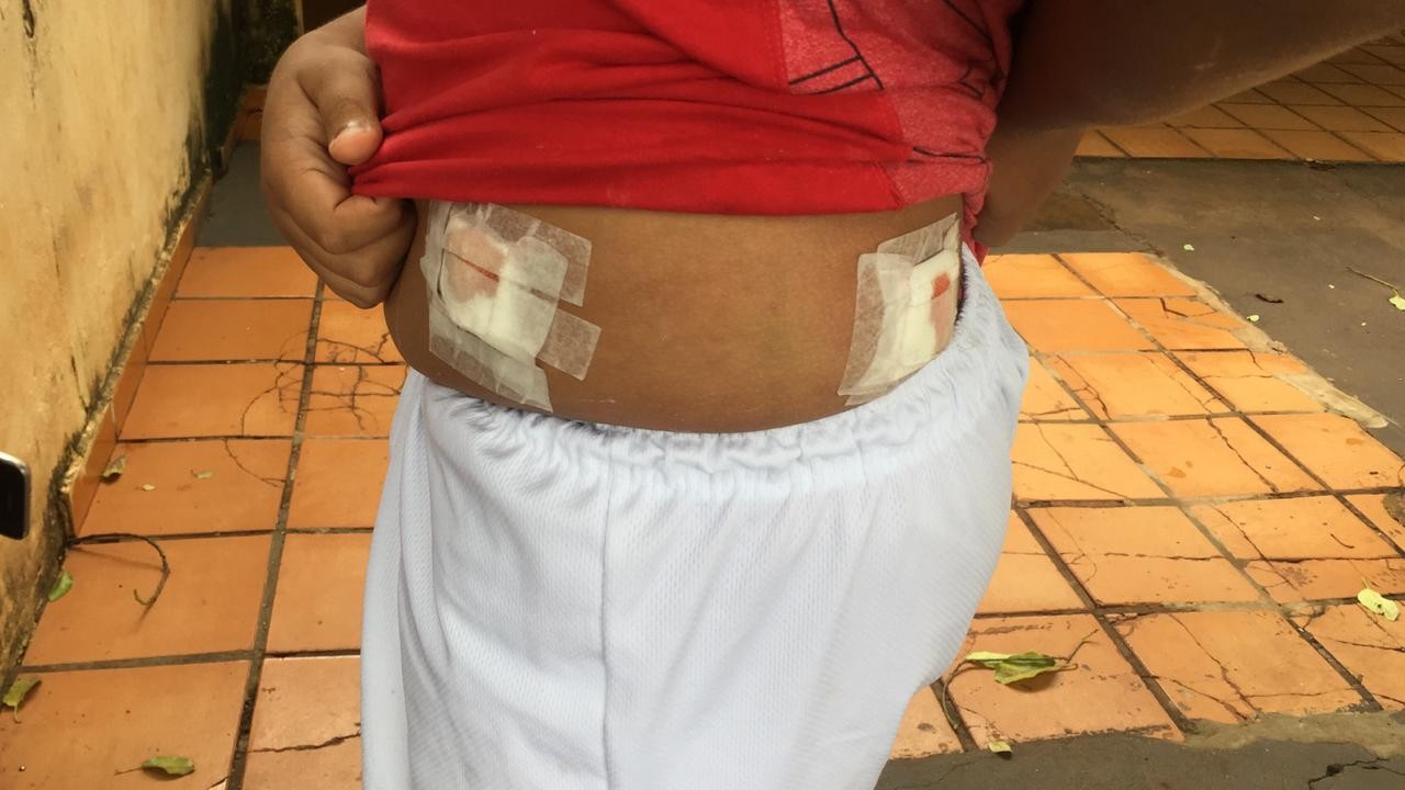 Polícia tem pistas de atiradores que balearam duas crianças e mataram um homem