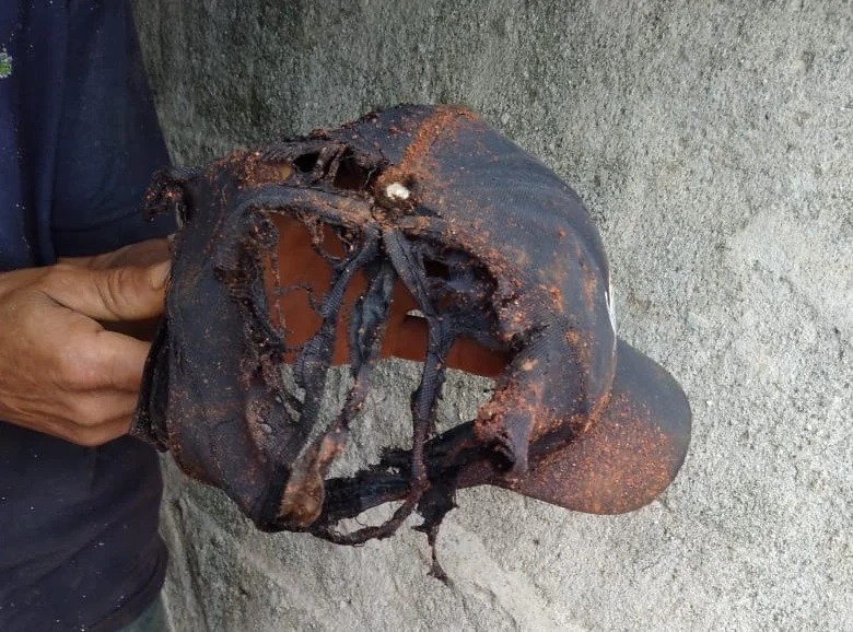 Trabalhador é atingido por raio na cabeça em Castro