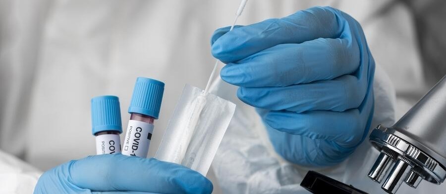 Confira os dados sobre Covid-19 desta terça-feira (13) em Maringá