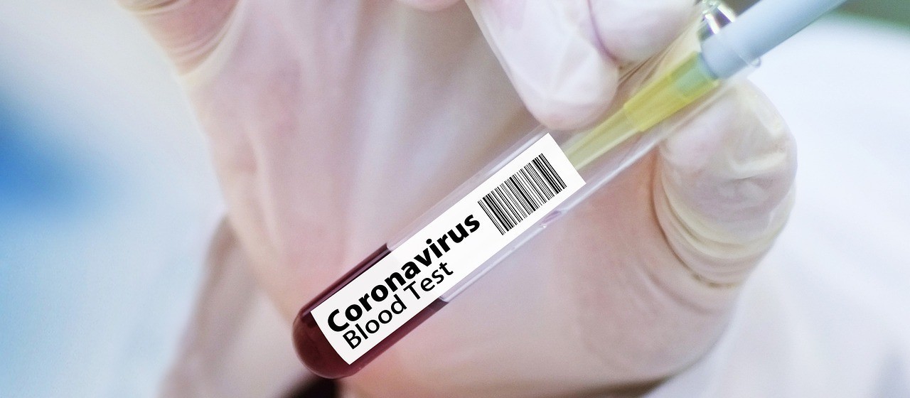 Confira os dados sobre coronavírus deste sábado (26)