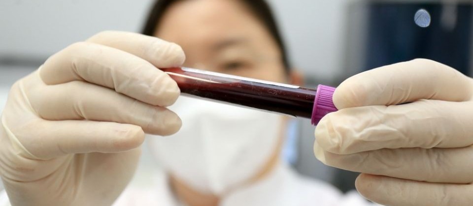 Maringá está desde o fim do ano passado sem divulgar dados de casos de Covid-19