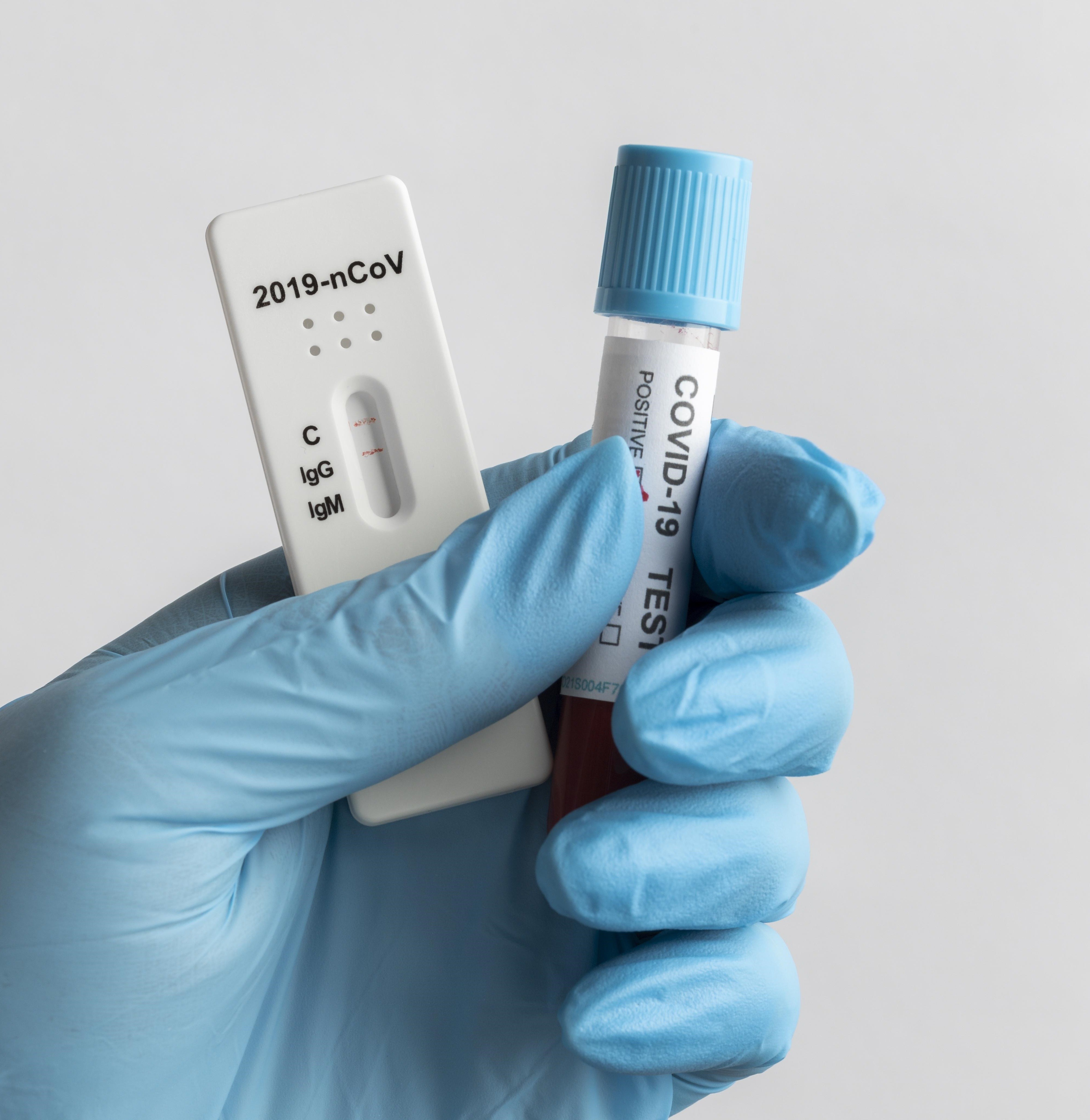 Confira os dados da Covid-19 em Maringá nesta terça-feira (11)