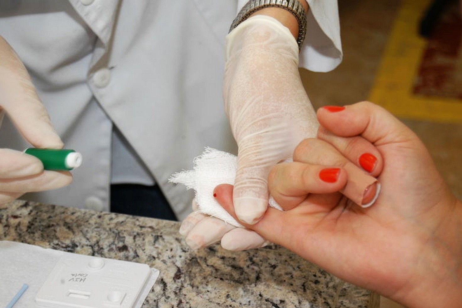 Em surto, Curitiba registra 150 casos de Hepatite A em 2024