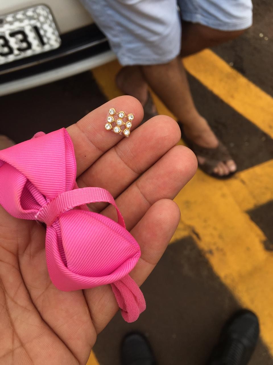 Menina de um ano engasga com pedras de enfeite de cabelo em Maringá