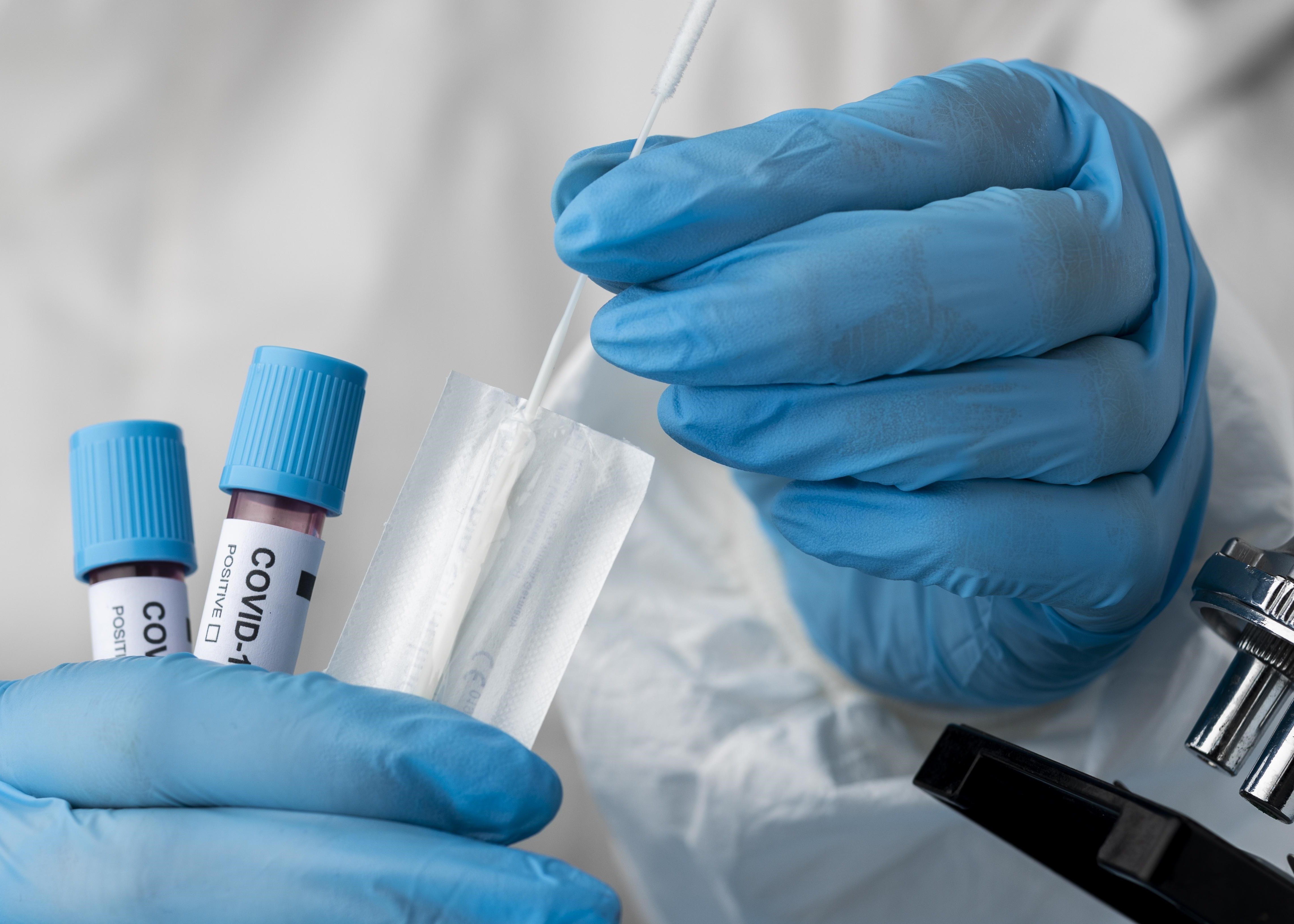 Confira os dados atualizados sobre a Covid-19 nesta sexta-feira (3)