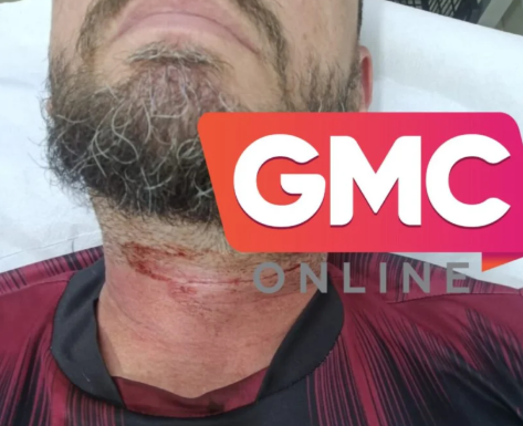 Motociclista sofre corte no pescoço provocado por linha chilena