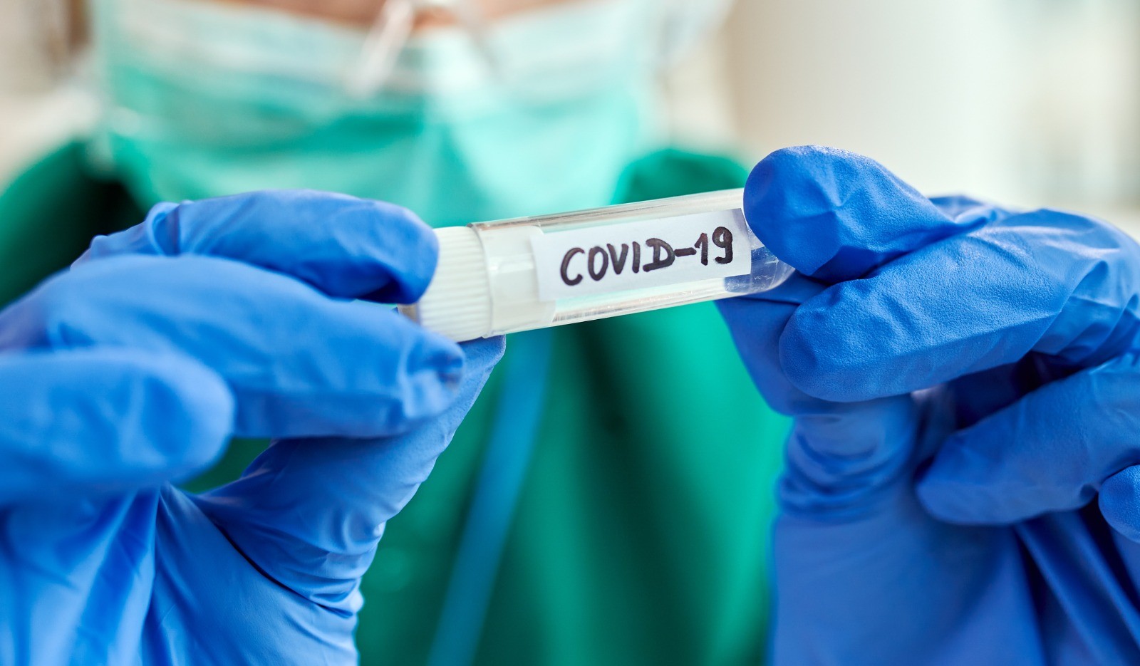 Confira o boletim quinzenal com dados da Covid-19