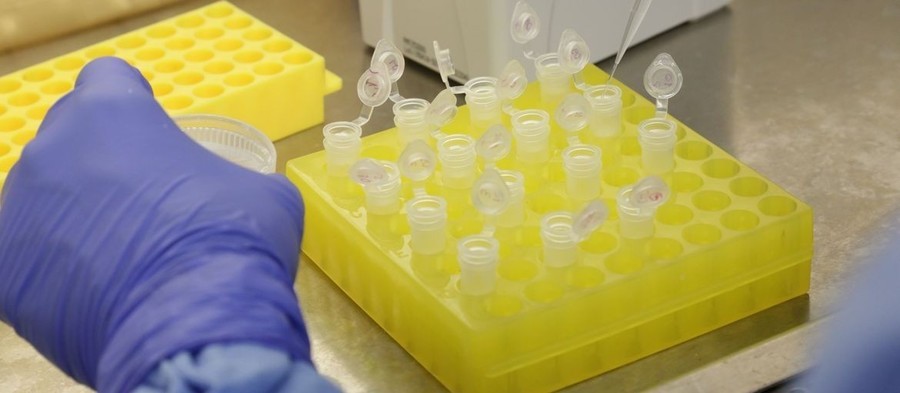 Cianorte: sobe para 11 o número de casos confirmados de Covid-19