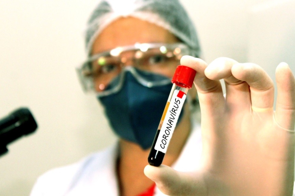 Saiba os dados do boletim sobre a Covid-19 desta sexta-feira (21) em Maringá