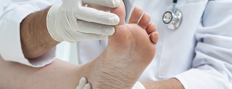 Diabetes provocou 162 amputações em cinco anos