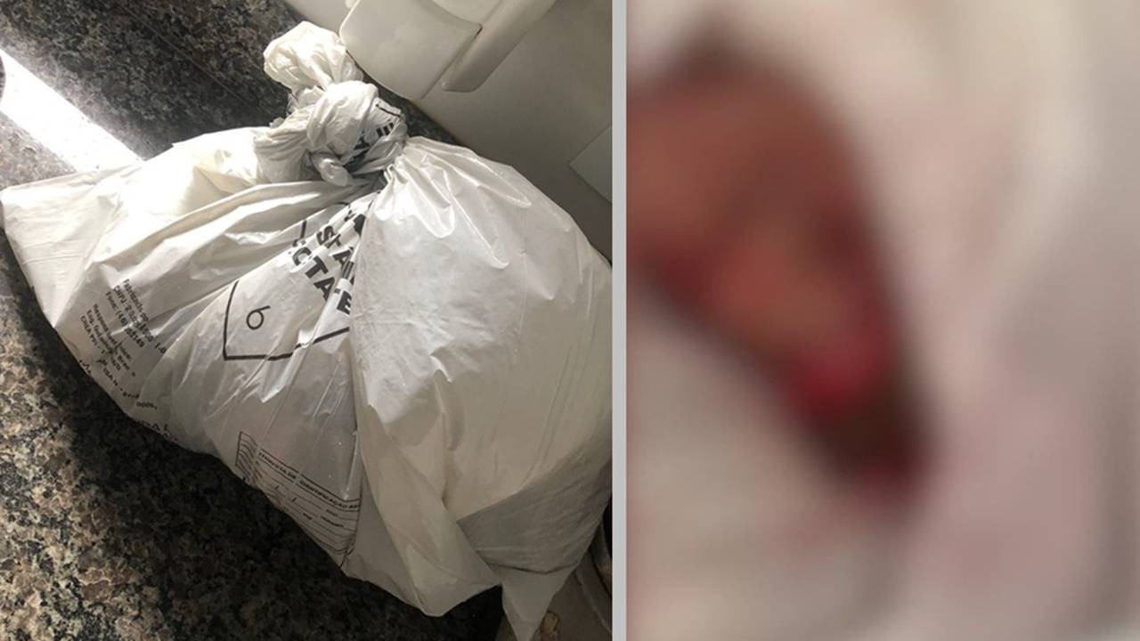 Família recebe sacola com pé amputado por engano durante velório em Cascavel