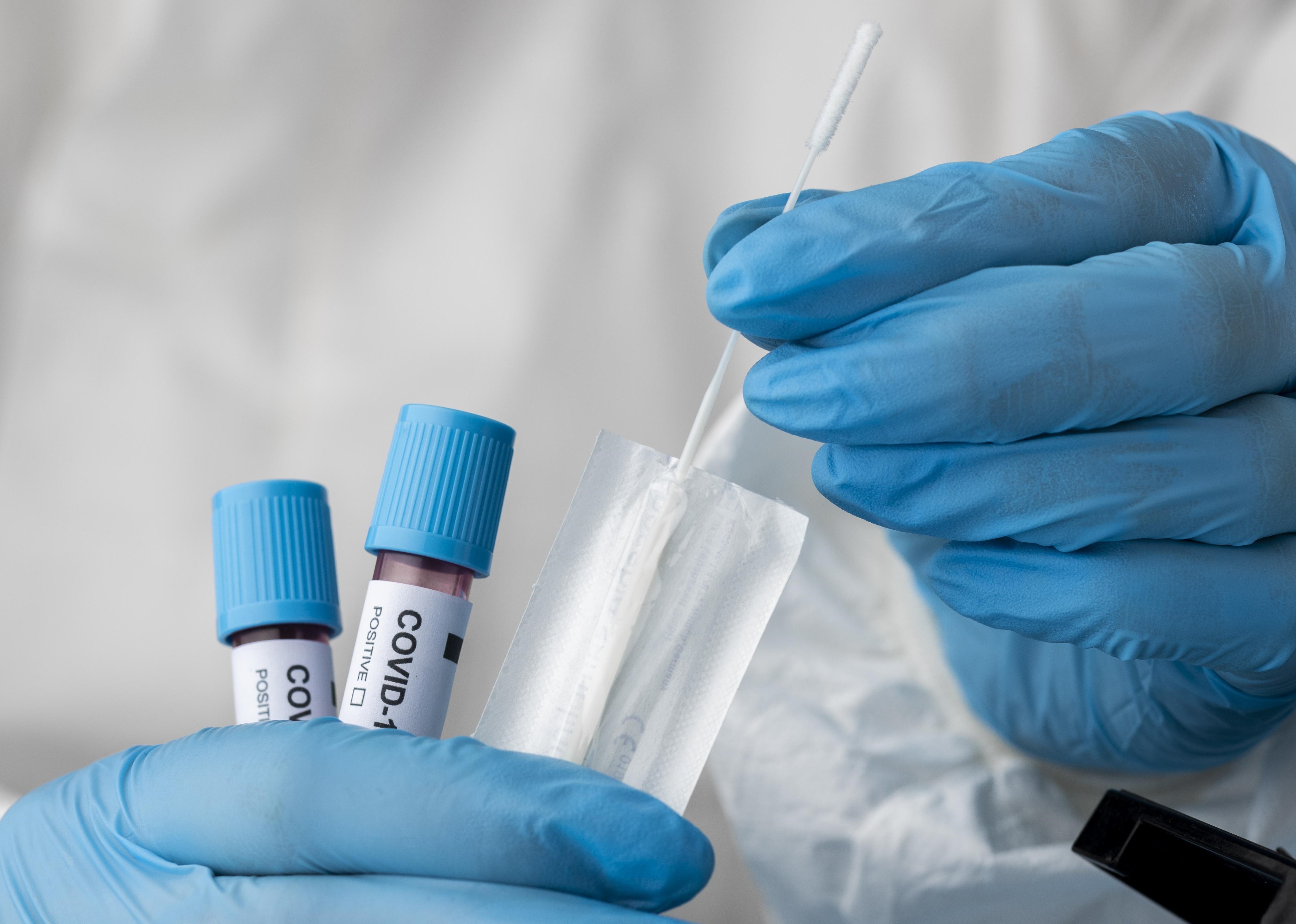 Confira o boletim quinzenal da Covid-19 em Maringá