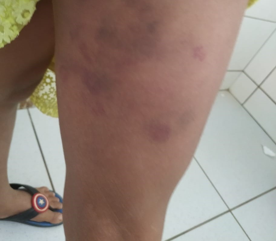 Pai é suspeito de agredir filha de 7 anos em Alto Paraná