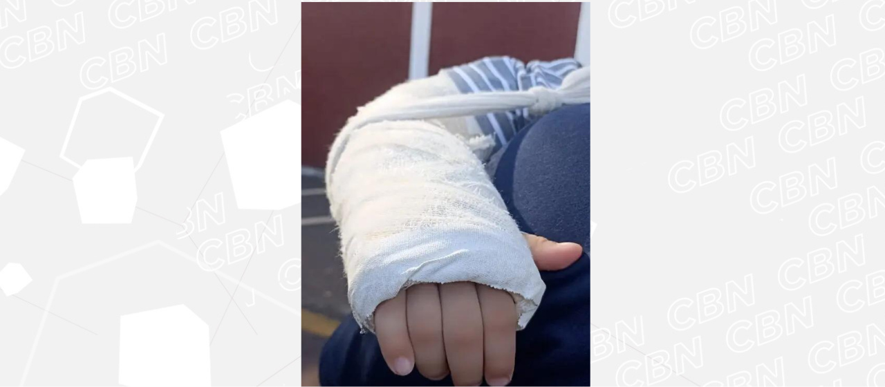 Criança volta de CMEI com braço quebrado e pais registram queixa