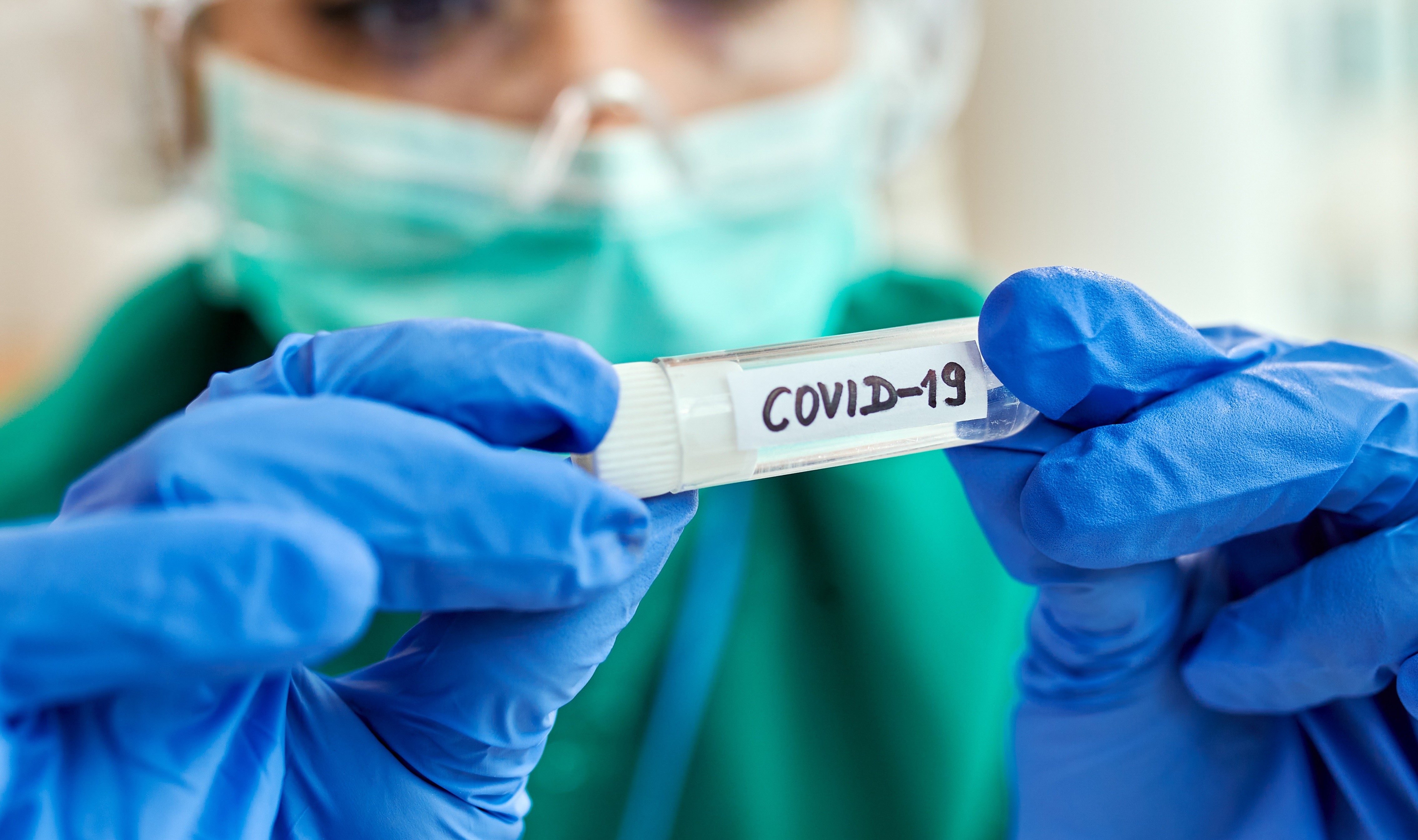 Confira o boletim quinzenal da Covid-19 desta terça-feira (2)