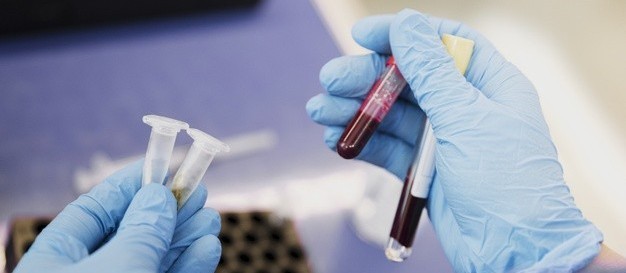 Confira o boletim de casos de coronavírus deste sábado (13)