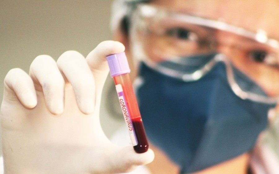 Covid-19 em Maringá: saiba os dados desta quarta-feira (18)