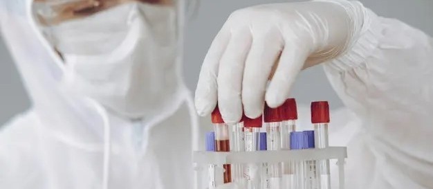 Confira os dados do boletim sobre Covid-19 desta sexta-feira (11) em Maringá