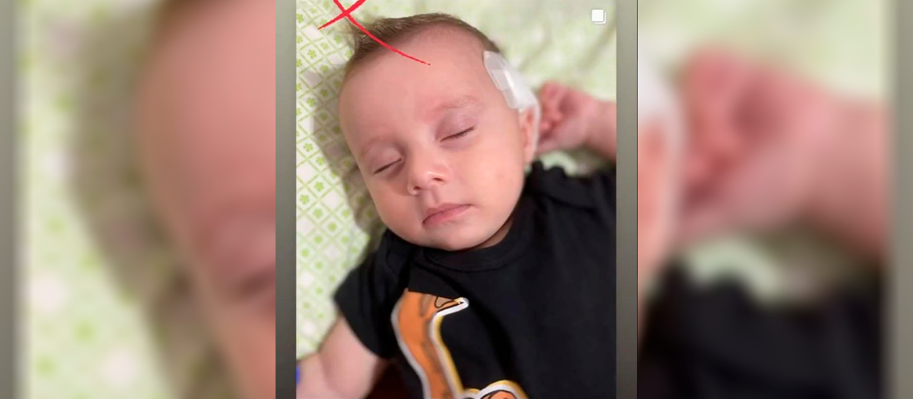 Cirurgia do menino José foi bem sucedida