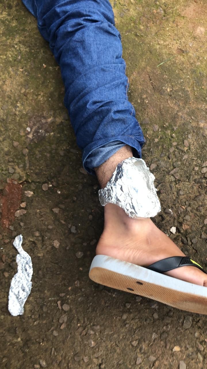 Suspeito cobre tornozeleira eletrônica com papel alumínio mas é preso