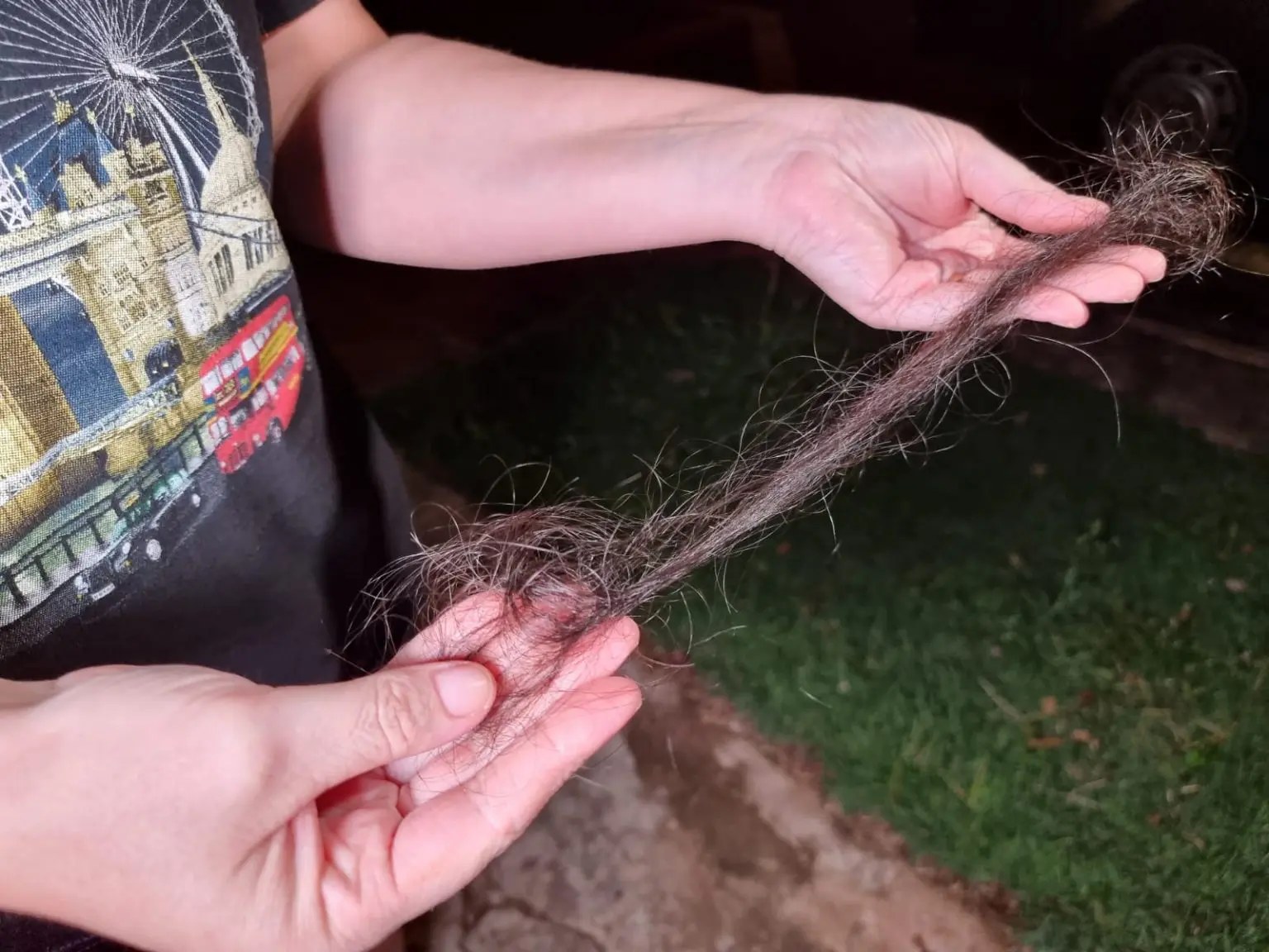 Assaltante disparou 3 vezes, diz estudante de Maringá que teve tufo de cabelo arrancado após tiro