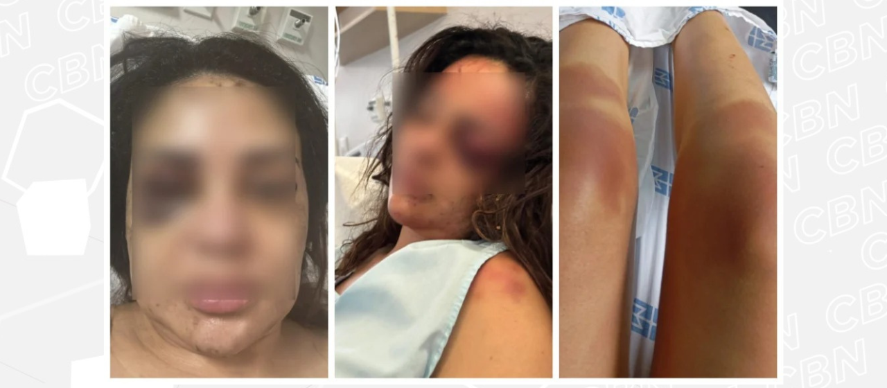 Médica espancada em apartamento relata momentos de terror