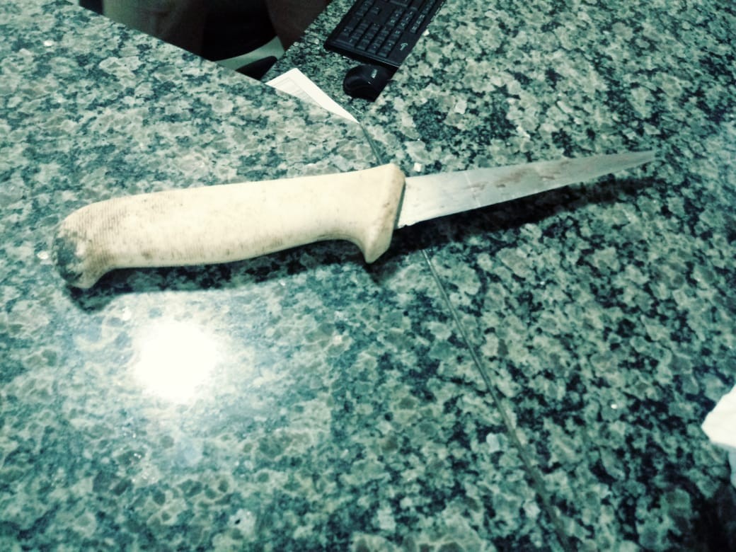 Durante roubo, homem é golpeado no rosto com faca ao tentar recuperar moto