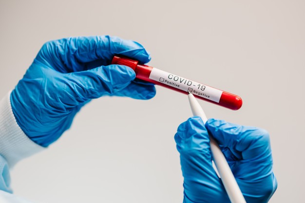 Oito moradores de Cianorte venceram o coronavírus