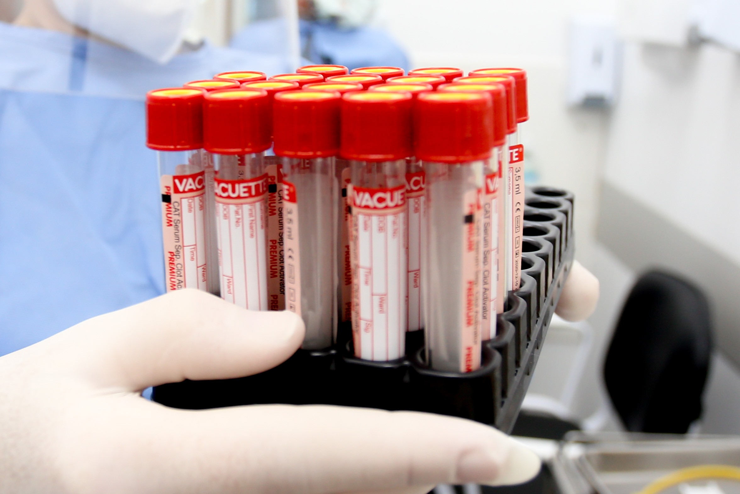 Maringá confirma o 4º caso de Monkeypox