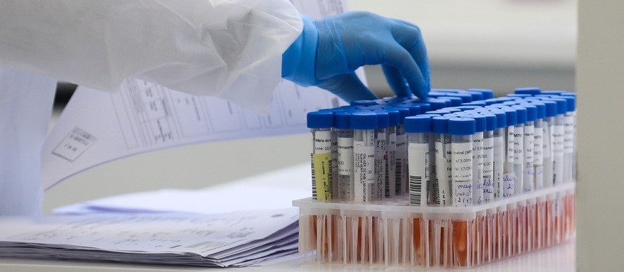 Confira o boletim diário sobre a Covid-19 neste domingo (16)