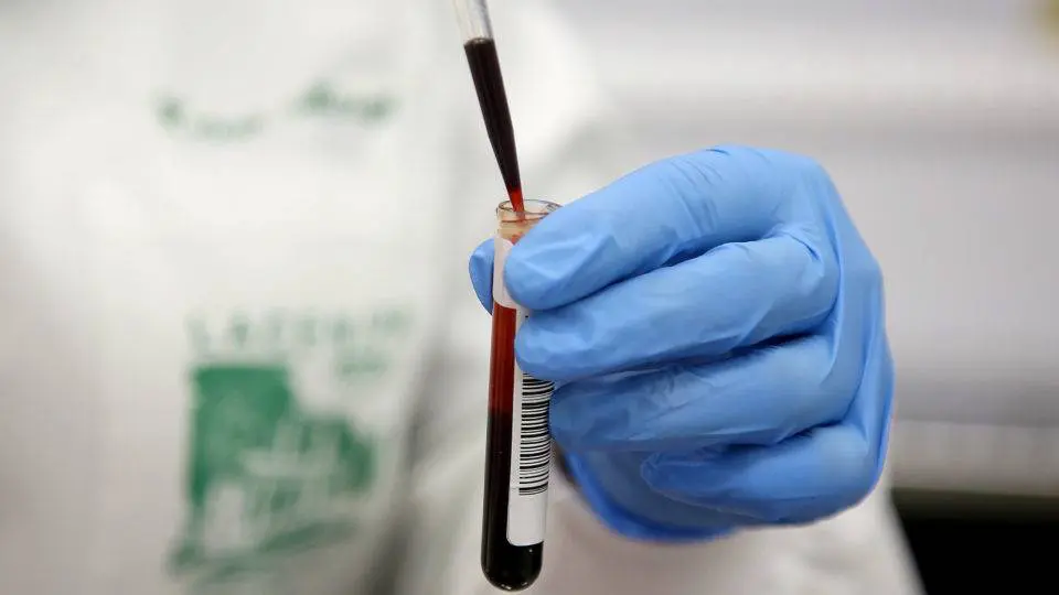 Covid-19: Maringá registra 622 novos casos e 5 óbitos no boletim desta quarta-feira (23)