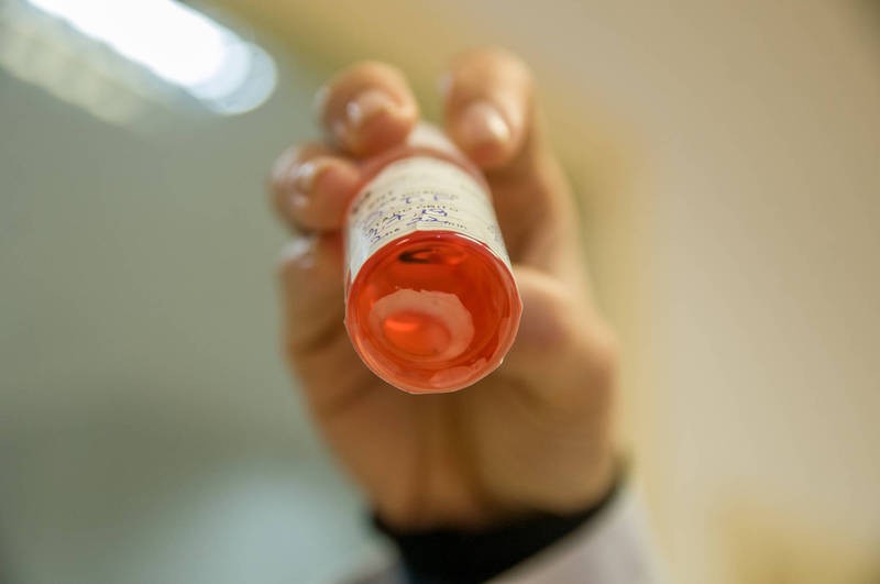 Sesa diz que até quinta-feira (26) abastecimento de conservantes será normalizado