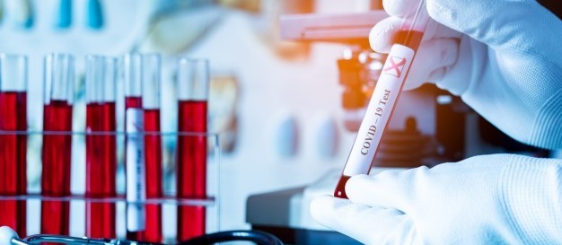 Covid-19: Maringá confirma 255 novos casos no boletim desta quinta-feira (24)