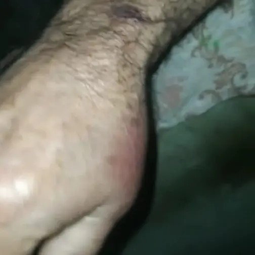 Família denuncia agressão de idoso com socos e pontapés durante assalto