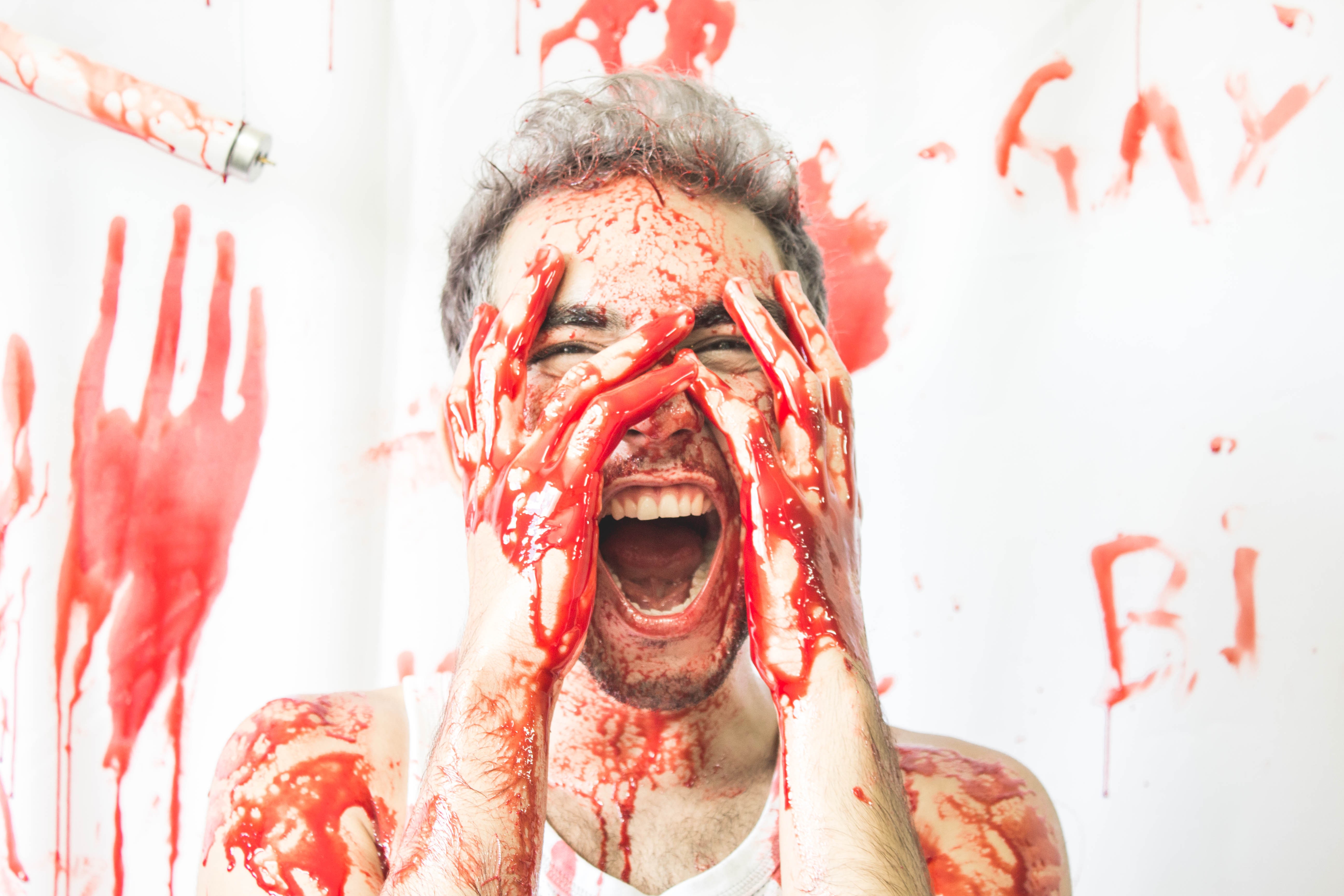 Fotos mostram violência contra população LGBTQI+