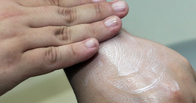 Dermatologista explica como aplicar o protetor solar de forma correta