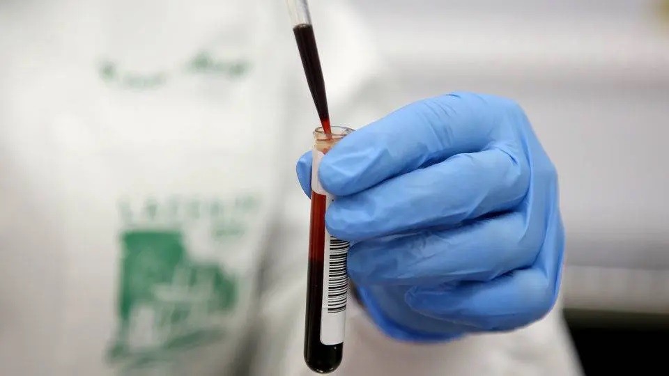 Covid-19: Maringá registra 977 novos casos e um óbito no boletim desta terça-feira (15)